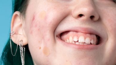 Photo of From Repairing Moisturizer to Acne Dots: Your Complete Breakout-Busting Skincare Routine