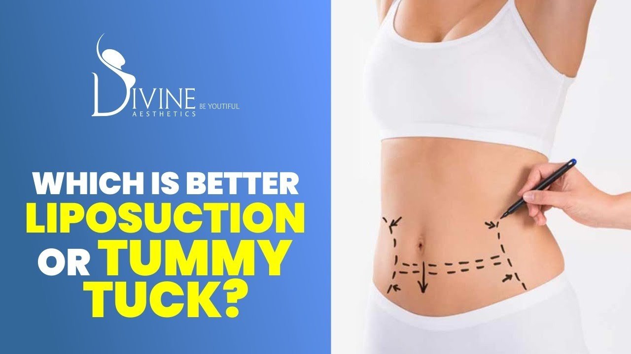 Difference Between Tummy Tuck And Liposuction Surgery