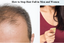 Photo of How to Stop Hair Fall in Men and Women