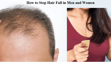 Photo of How to Stop Hair Fall in Men and Women