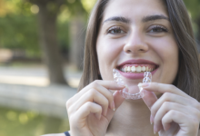 Photo of How do Braces Affect the Facial Structure?
