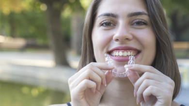 Photo of How do Braces Affect the Facial Structure?
