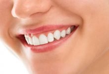Photo of Top 4 Benefits of Teeth Whitening Treatment