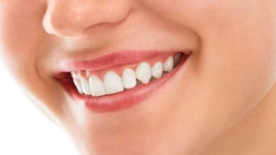 Photo of Top 4 Benefits of Teeth Whitening Treatment