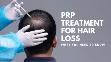 Photo of PRP Treatment for Hair Loss – What You Need to Know