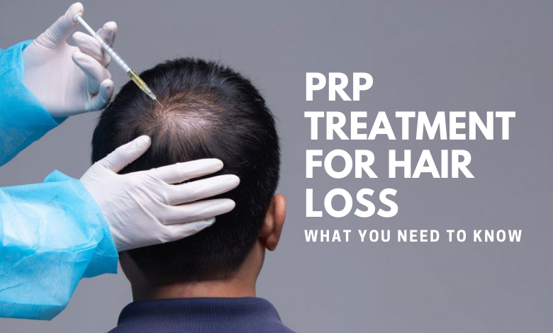 Photo of PRP Treatment for Hair Loss – What You Need to Know