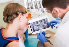 Photo of Important Diagnostic Tests Need to Do before Dental Implant Treatment