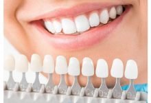 Photo of Is Whitening Possible for Old Dental Works and Crowns?