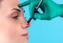 Photo of Know Everything Before Opting for Rhinoplasty