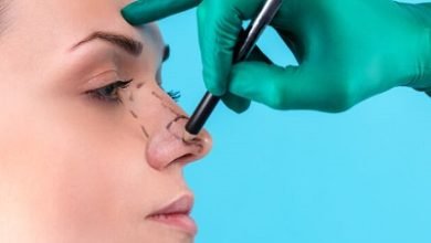 Photo of Know Everything Before Opting for Rhinoplasty