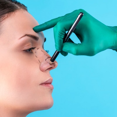 Photo of Know Everything Before Opting for Rhinoplasty