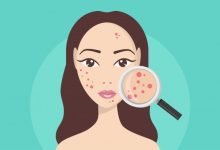 Photo of The best strategy to use avocado oil on your skin