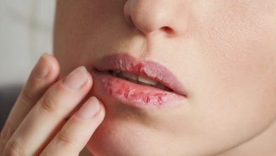 Photo of Antifungal Cream For Lips Protects Your Lips Throughout The Year!
