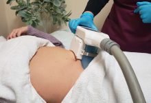 Photo of Why Is Coolsculpting Treatment So Expensive?