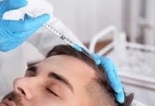 Photo of What Things & Foods Should You Avoid After Hair Transplant Procedure?