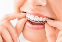 Photo of How to Prepare for Invisalign Retainers