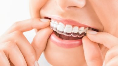 Photo of How to Prepare for Invisalign Retainers
