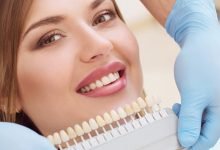 Photo of The Benefits of Temporary Veneers