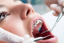 Photo of Which Orthodontic Treatment is Best for Me?