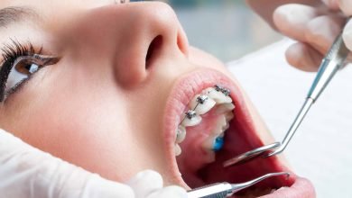 Photo of Which Orthodontic Treatment is Best for Me?