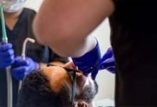 Photo of Need Emergency Root Canals Near Me?