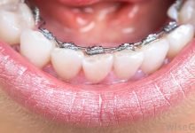 Photo of Orthodontist Near Me: What is an Orthodontist?