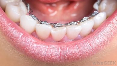 Photo of Orthodontist Near Me: What is an Orthodontist?