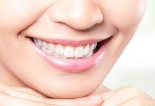 Photo of You Need to Know These Things Before Getting Your Teeth Professionally Whitened