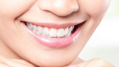 You Need to Know These Things Before Getting Your Teeth Professionally Whitened