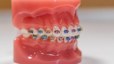 Photo of The Dangers Of Braces and Power Chains
