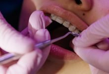 Photo of Everything You Wanted to Know About Orthodontists But Were Afraid to Ask