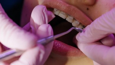 Photo of Everything You Wanted to Know About Orthodontists But Were Afraid to Ask