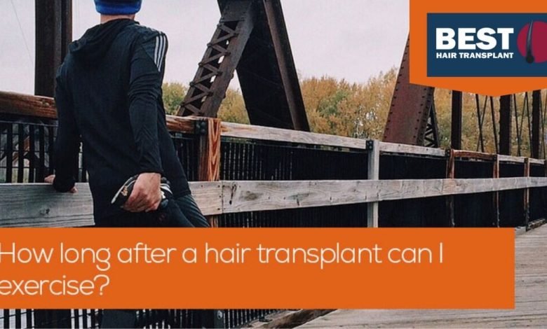 how-long-after-hair-transplant-can-exercise