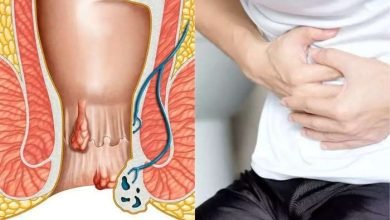 Photo of Minimally Invasive Procedures: Piles Treatment