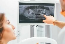Photo of The Invisalign Eating and Drinking Guidelines