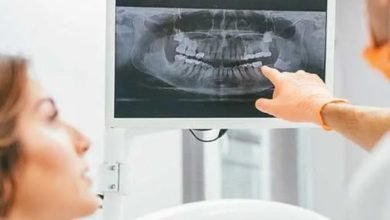 Photo of The Invisalign Eating and Drinking Guidelines