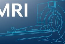 Photo of Magnetic Resonance Imaging (MRI) is an advanced technology