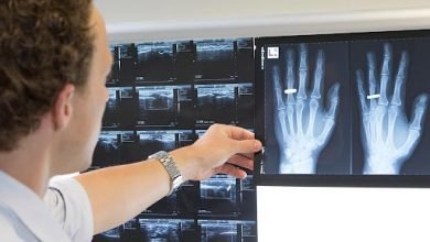 Photo of Musculoskeletal injections are a safe and modern procedure