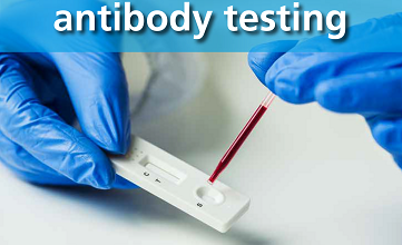 Photo of When Should Antibody Testing Be Performed, and Why Is It Required?