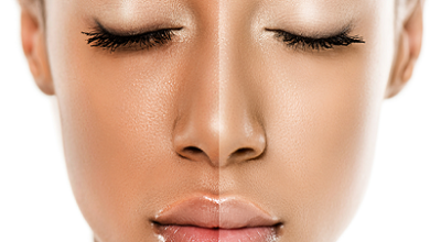 Photo of Best Glutathione injections in Dubai