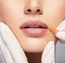 Photo of Lip Fillers Vs Lip Augmentation: What is the Difference?